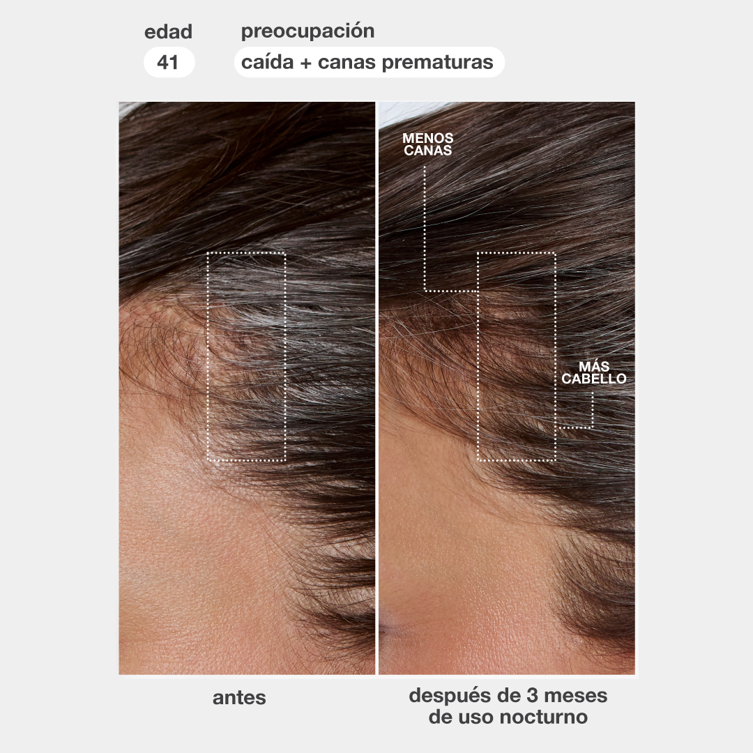 FutureIQ™ sérum biomimético para la longevidad capilar 90ml - Imagen 10