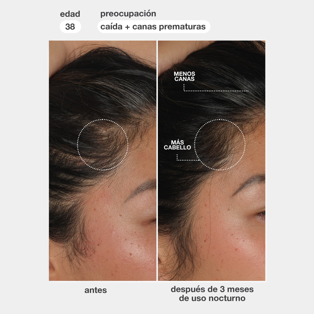 FutureIQ™ sérum biomimético para la longevidad capilar 90ml - Imagen 9